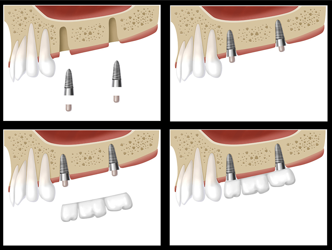 Empress Walk Dental Toronto