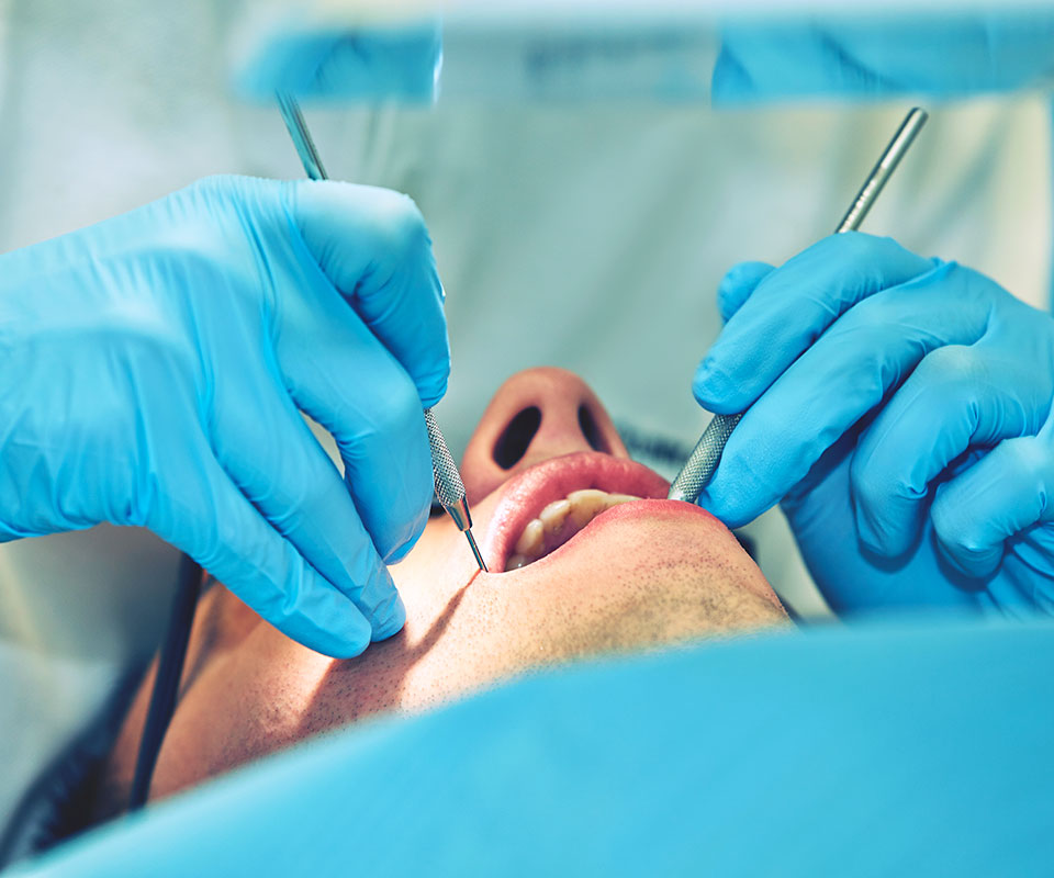 Root Canal Retreatment North York